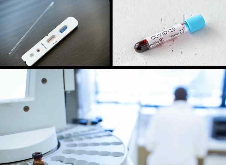 metodos laboratoriais covid