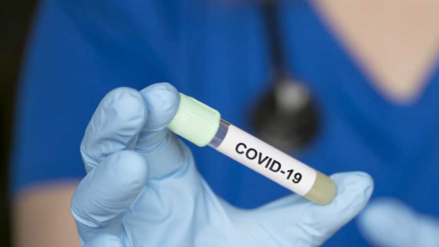 teste de covid 19
